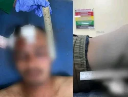 PRIA ASAL PALUPUH DITEMUKAN BERSIMBAH DARAH DI GELANGGANG PACU KUDA BUKIT AMBACANG, POLISI LAKUKAN PENYELIDIKAN